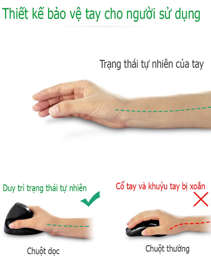 Chuột Đứng Không Dây Chống Mỏi Tay MS1354 